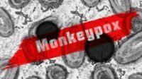 monkeypox